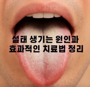 설태 썸네일 이미지로 남성이 혀를 내밀었는데 설태가 가득 낀 사진이다.